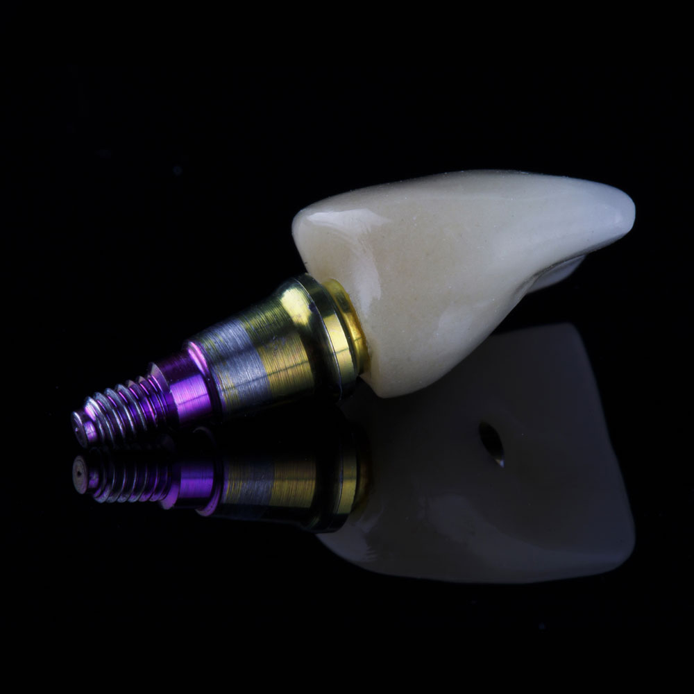 Denoray Dental Services_Service_custom-abutments